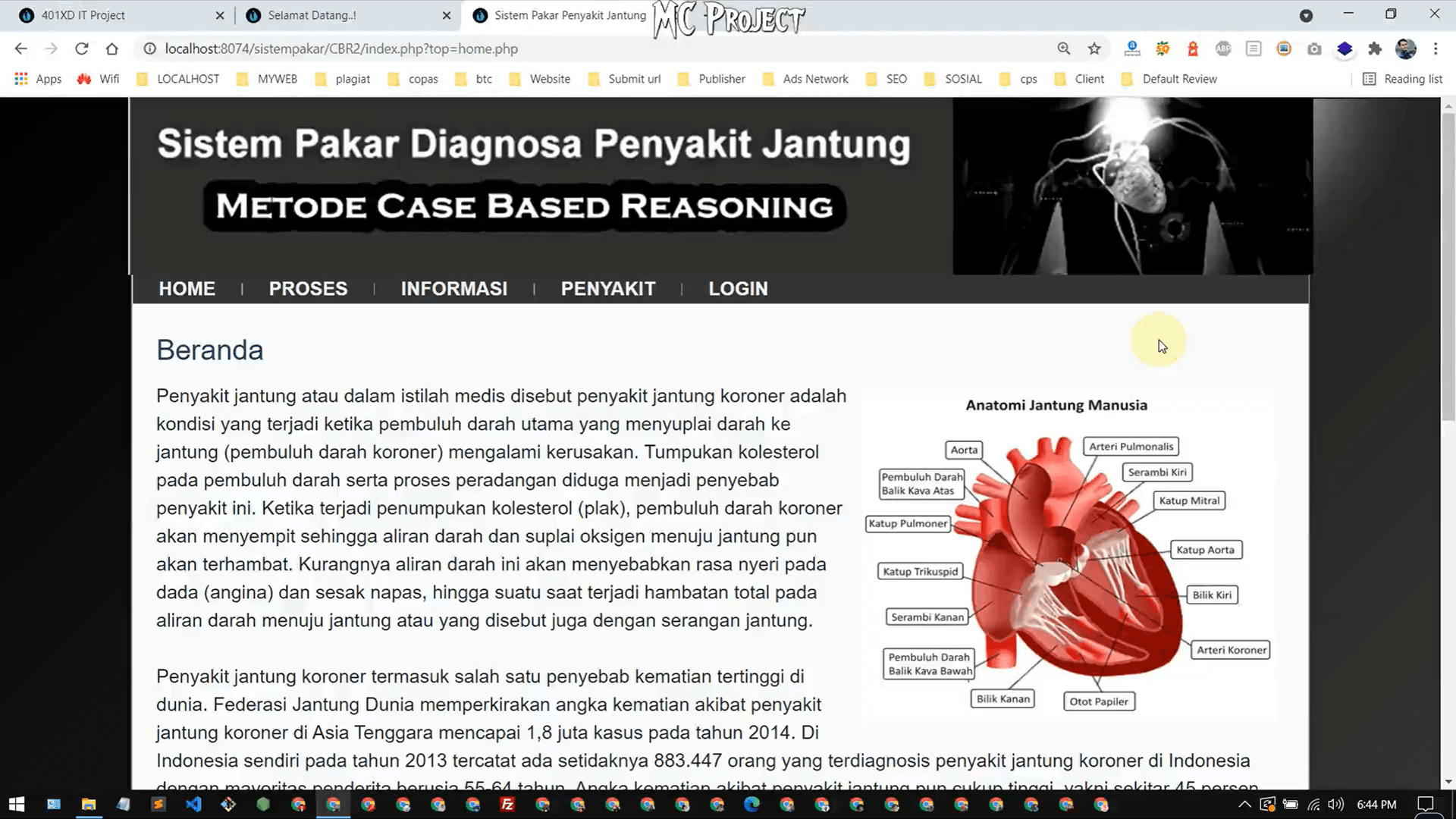 Source Code Sistem Pakar Cbr &amp; Fuzzy Mamdani V1 (diagnosa Jantung)